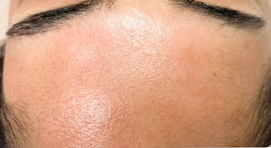 Silky Glow Facial After